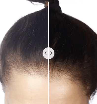Brosse à Cheveux Multifonctionnelle 5-en-1 | Massage du Cuir Chevelu et Hydratation