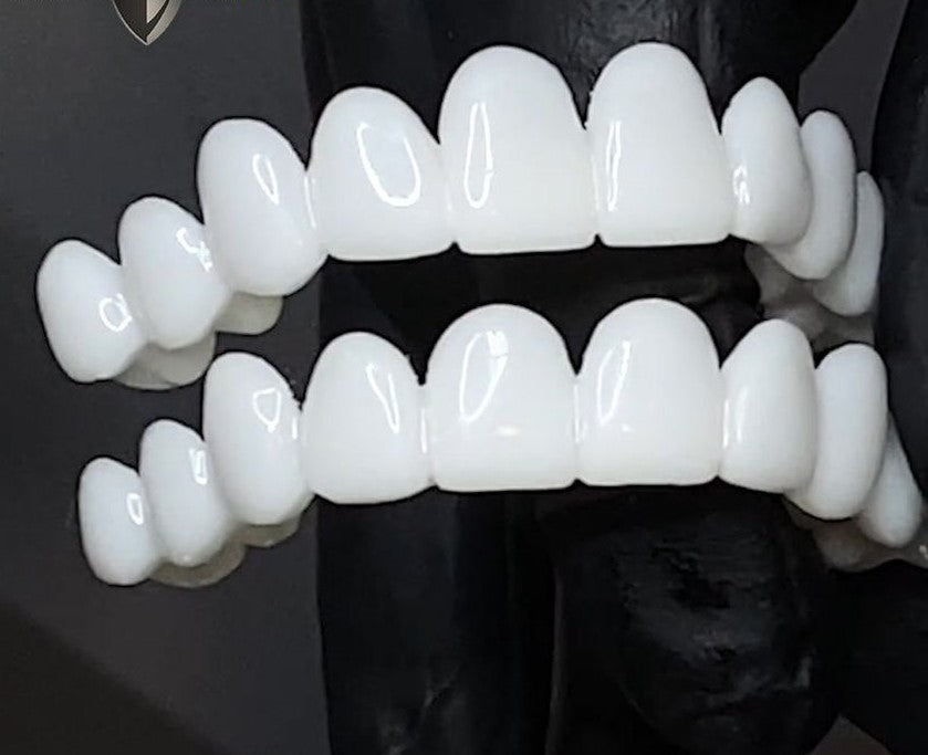 Prothèses Dentaires Sur Mesure | Restaurez Votre Sourire Naturel