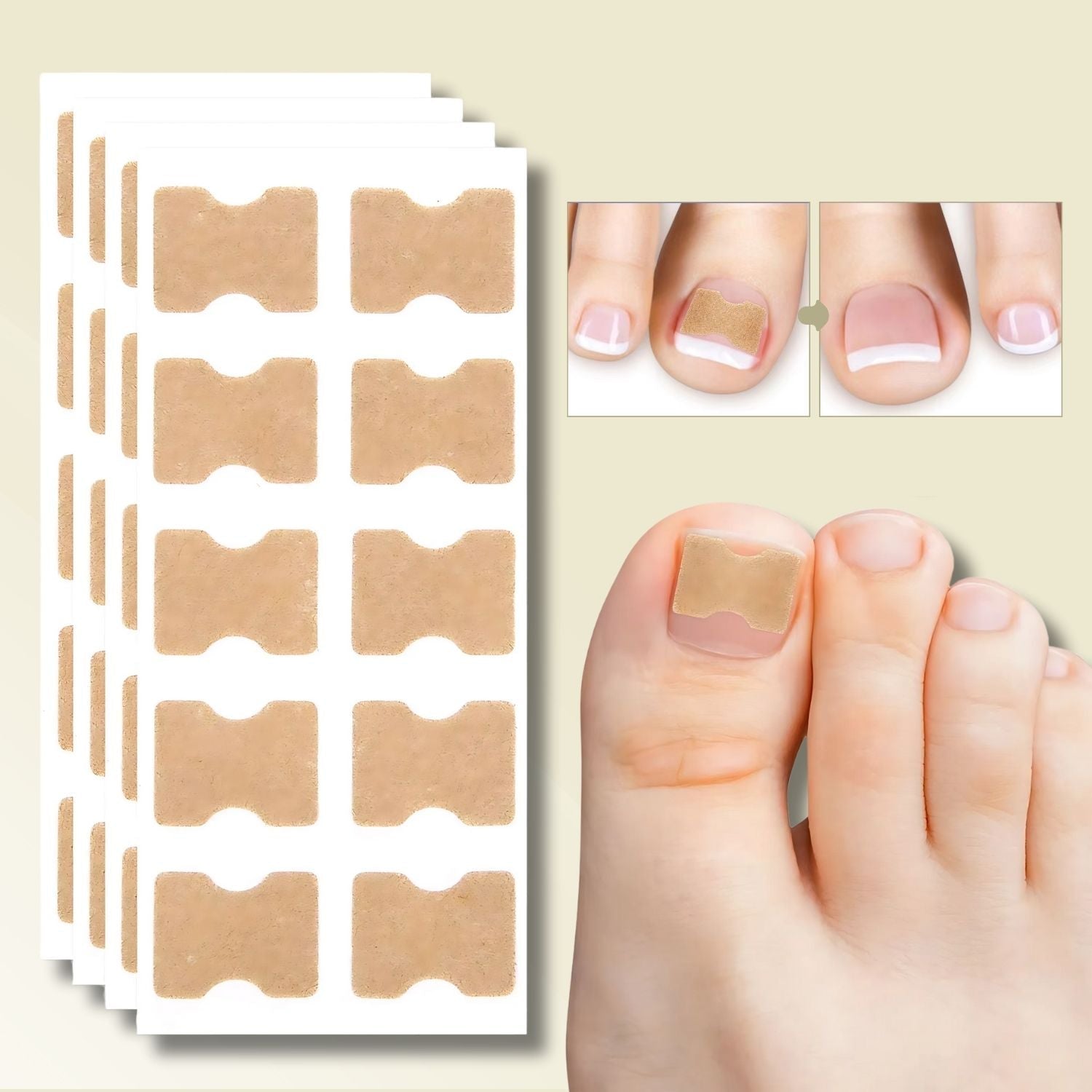 Patches pour Ongles Incarnés et Mycose | Soulagement Instantané et Croissance Saine