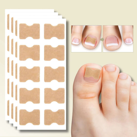 Patches pour Ongles Incarnés et Mycose | Soulagement Instantané et Croissance Saine