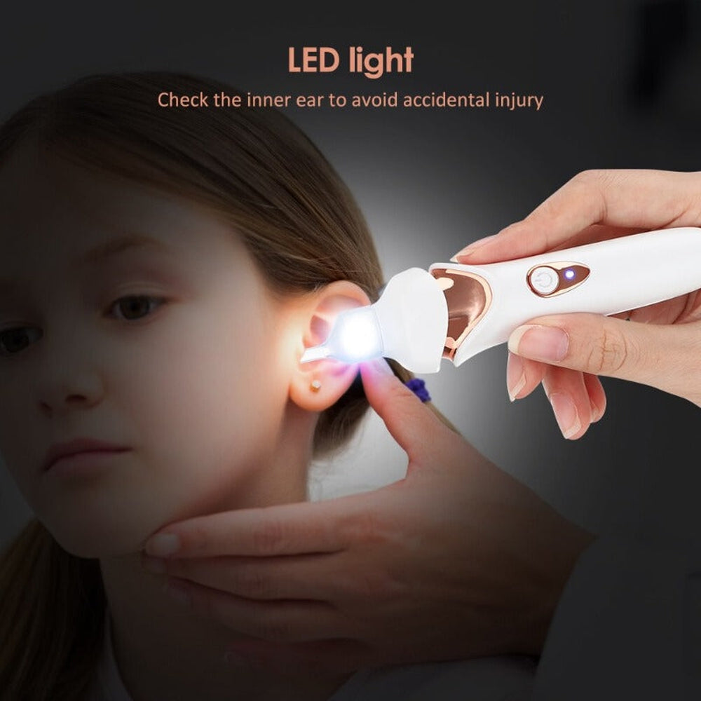Éliminateur de Cérumen Rechargeable | Indolore et Sûr avec Lumière LED
