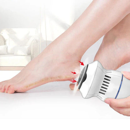 Épilateur Électrique pour Pieds | Élimination Douce des Callosités