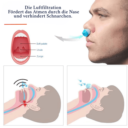 Dispositif Anti-Ronflement Efficace | Sommeil Réparateur et Purification d'Air
