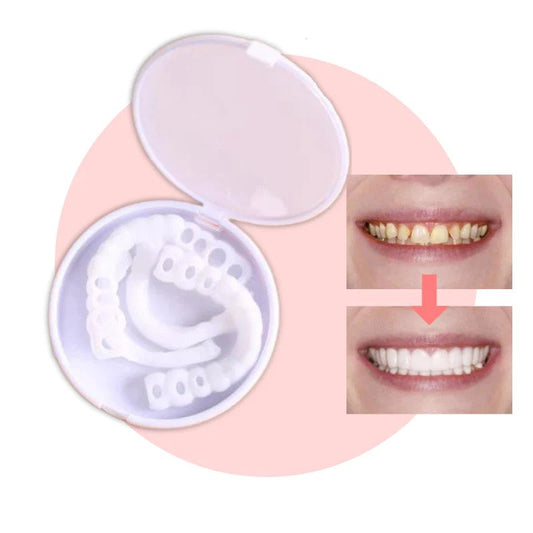 Facettes Dentaires Réutilisables | Sourire Parfait et Confort Optimal