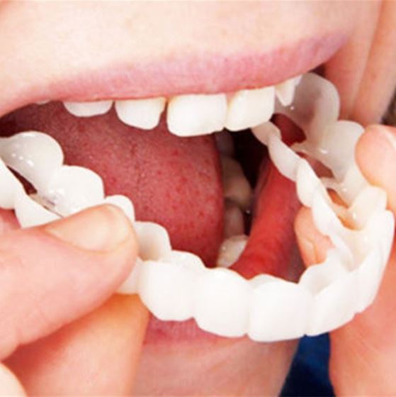 Facettes Dentaires Réutilisables | Sourire Parfait et Confort Optimal