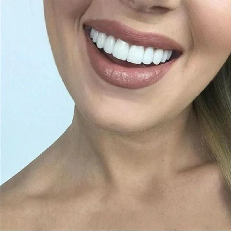 Facettes Dentaires Personnalisables | Sourire Éclatant et Réutilisable