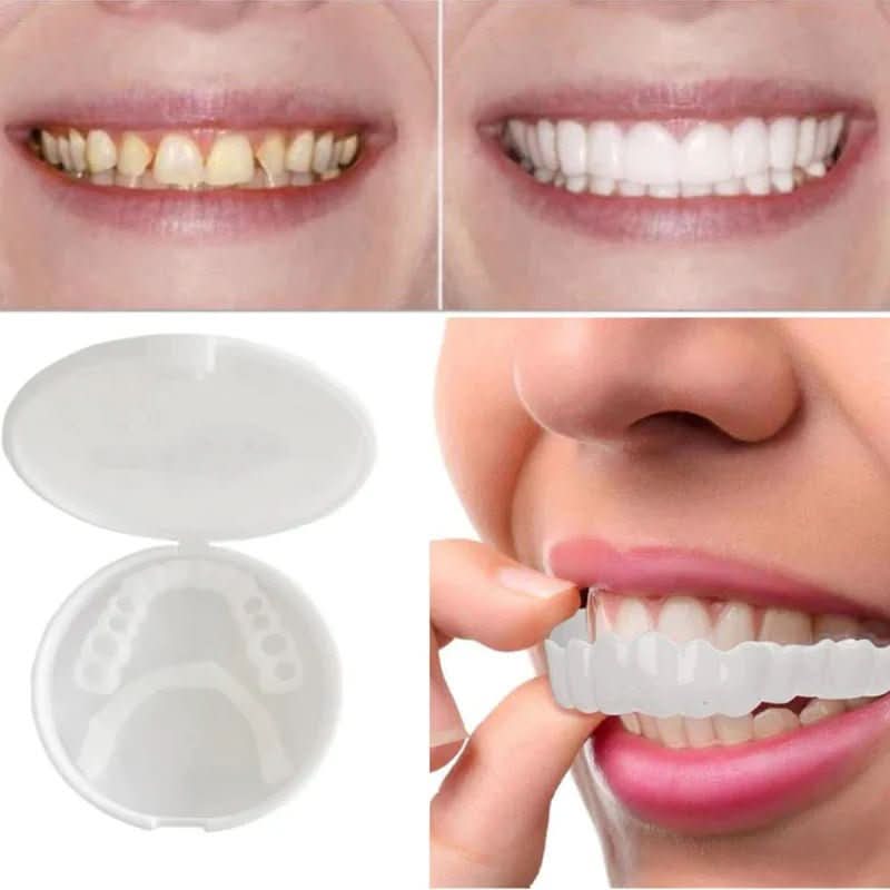 Facettes Dentaires Personnalisables | Sourire Éclatant et Réutilisable