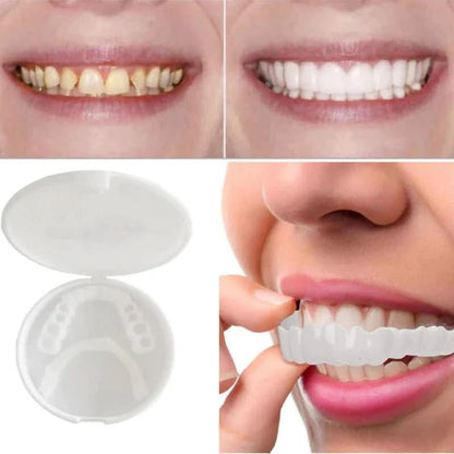 Facettes Dentaires Personnalisables | Sourire Éclatant et Réutilisable